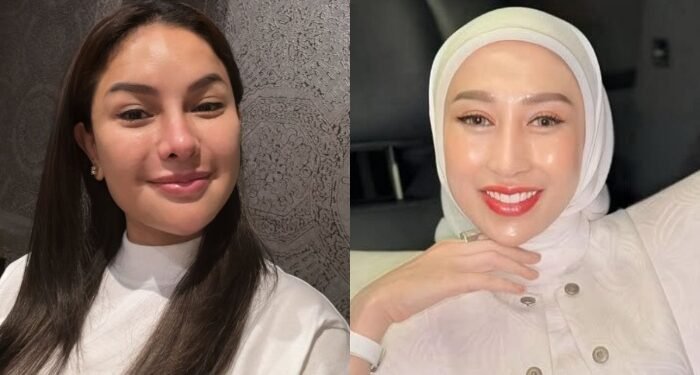 Artis Nikita Mirzani (kiri) dan dokter kecantikan, Reza Gladys (kanan). (Instagram.com / @nikitamirzanimawardi_172 - @rezagladys)